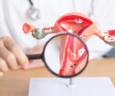 ovarian cyst diagnosis